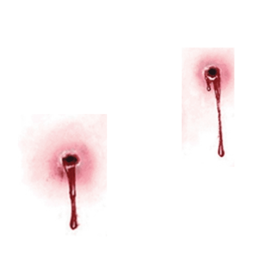 Vampire Bite